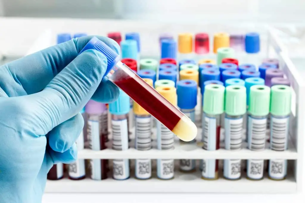 Mobile phlebotomist collecting a specimen
